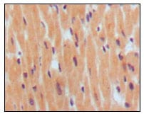 Mouse Monoclonal Antibody to BNP