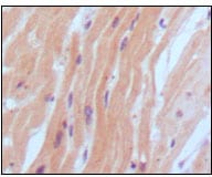 Mouse Monoclonal Antibody to BNP