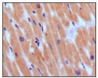 Mouse Monoclonal Antibody to BNP