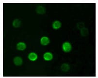 Mouse Monoclonal Antibody to CD20