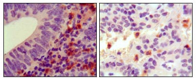 Mouse Monoclonal Antibody to HCK
