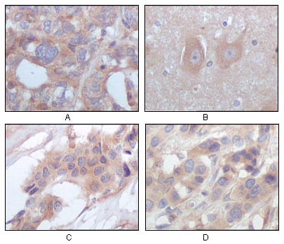 Mouse Monoclonal Antibody to STYK1