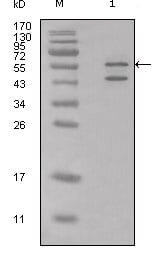 Rabbit Polyclonal Antibody to Calreticulin