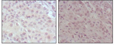 Mouse Monoclonal Antibody to MLL
