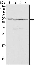 Mouse Monoclonal Antibody to Calreticulin