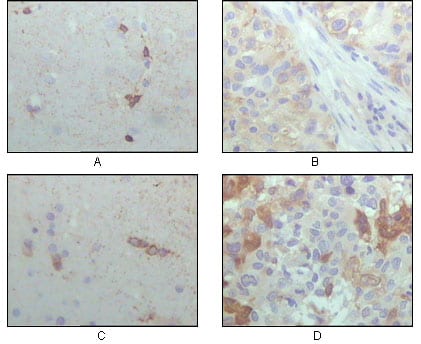 Mouse Monoclonal Antibody to CRYAB
