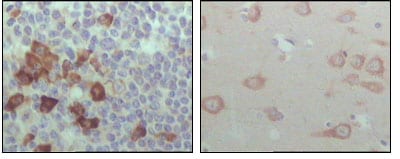 Mouse Monoclonal Antibody to EhpB6