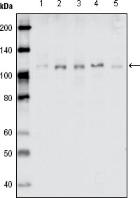 Mouse Monoclonal Antibody to EhpB1