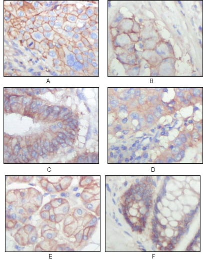 Mouse Monoclonal Antibody to EphB3