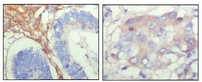 Mouse Monoclonal Antibody to FBLN5