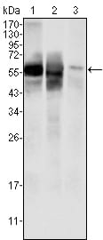 Mouse Monoclonal Antibody to Glucose-6-phosphate isomerase