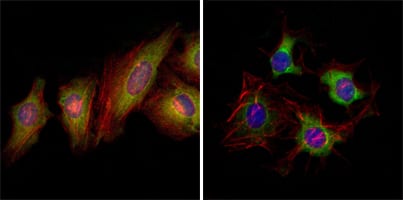 Mouse Monoclonal Antibody to EphB2