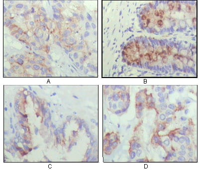 Mouse Monoclonal Antibody to IGFBP2