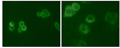 Mouse Monoclonal Antibody to Tyro3