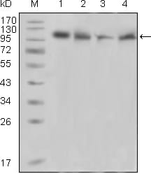 Mouse Monoclonal Antibody to PYK2