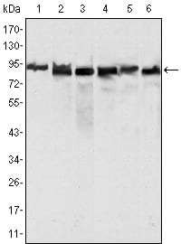 Mouse Monoclonal Antibody to MLH1
