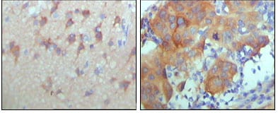 Mouse Monoclonal Antibody to ERBB3