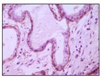 Mouse Monoclonal Antibody to CD10