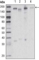 Mouse Monoclonal Antibody to RON