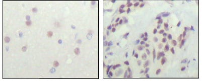Mouse Monoclonal Antibody to NCOR1