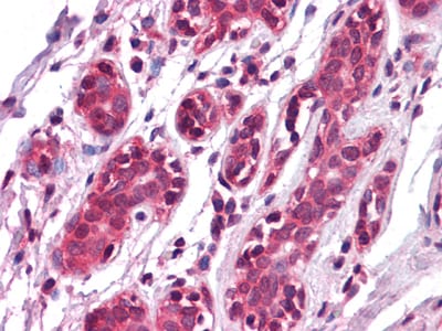 Mouse Monoclonal Antibody to EphA7