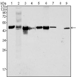 Mouse Monoclonal Antibody to Cytokeratin 18