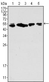 Mouse Monoclonal Antibody to Cytokeratin 8
