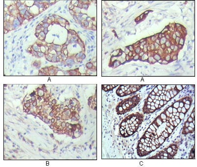 Mouse Monoclonal Antibody to Cytokeratin 19