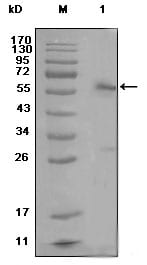 Mouse Monoclonal Antibody to ESR1