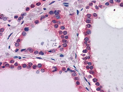 Mouse Monoclonal Antibody to LAMB1