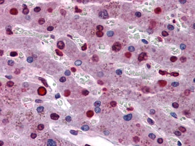 Mouse Monoclonal Antibody to STAT3