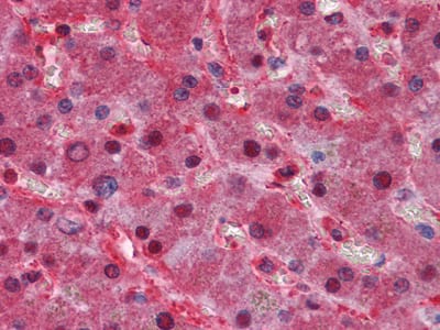 Mouse Monoclonal Antibody to LPA