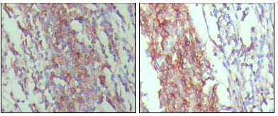 Mouse Monoclonal Antibody to CD45