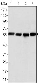 Mouse Monoclonal Antibody to Vimentin