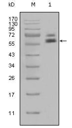Mouse Monoclonal Antibody to Cytokeratin 5