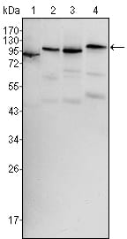 Mouse Monoclonal Antibody to BRAF