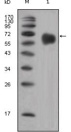 Mouse Monoclonal Antibody to FGFR4