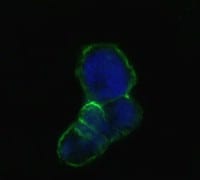 Mouse Monoclonal Antibody to LCN1