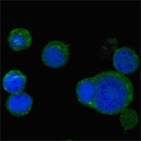 Mouse Monoclonal Antibody to WNT5A