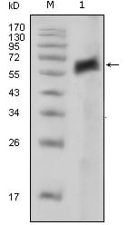 Mouse Monoclonal Antibody to AXL