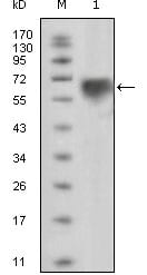 Mouse Monoclonal Antibody to TYRO3