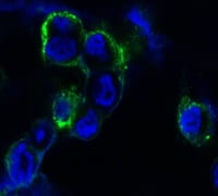 Mouse Monoclonal Antibody to EPHB4