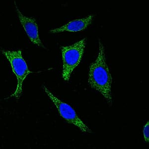 Mouse Monoclonal Antibody to Cytokeratin(Pan)