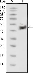 Mouse Monoclonal Antibody to p53