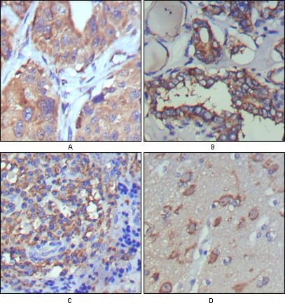 Mouse Monoclonal Antibody to WNT5A