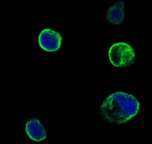 Mouse Monoclonal Antibody to MUSK