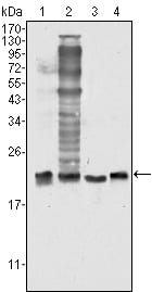 Mouse Monoclonal Antibody to SOD1