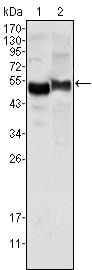 Mouse Monoclonal Antibody to AAT