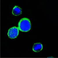Mouse Monoclonal Antibody to REG1A