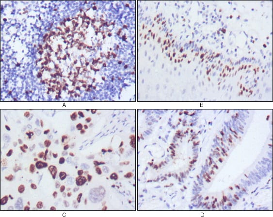 Mouse Monoclonal Antibody to KI67